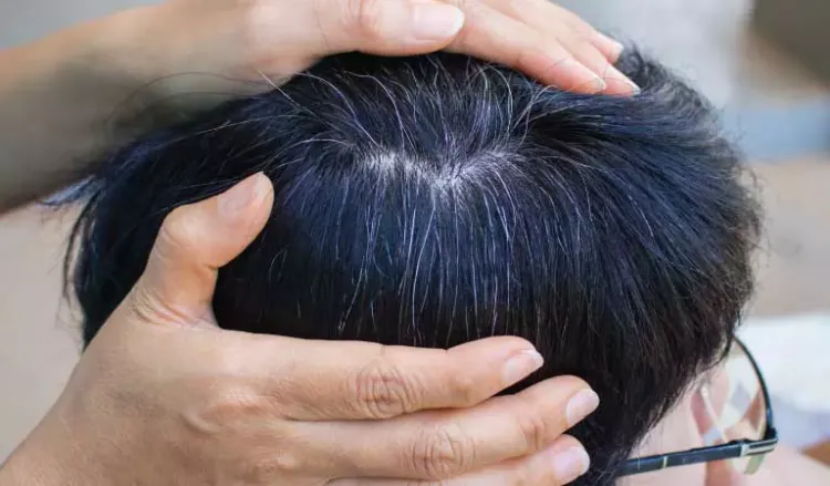 Sadly that more and more people among 30 years old are affected with this  problem of graying and white hairs The  White hair solution Hair  solutions White hair