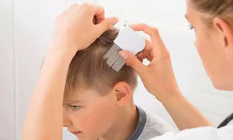 Hair Loss in Children | Causes of Hair Loss | Dr Batra's™