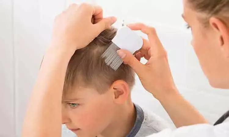 Hair Loss in Children