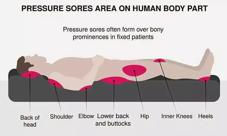 Can the painful bedsore on my back ever be cured?