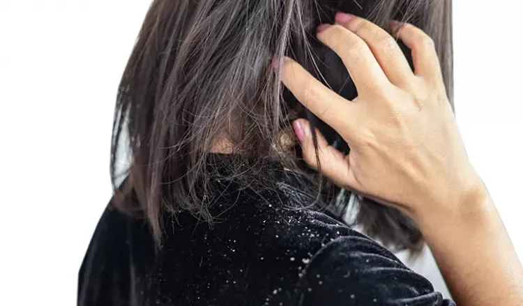 Does New Hair Treatment help treat dandruff?