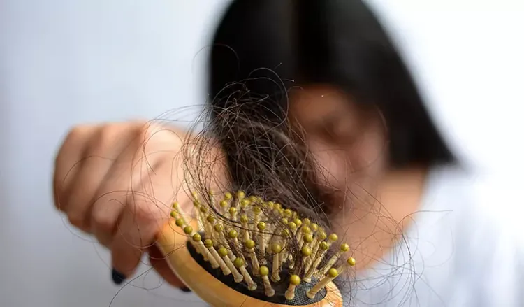 Factors responsible for hair fall in women