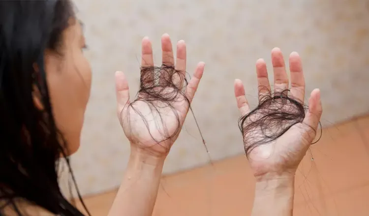 Effective Home Remedies for Hair Fall in Monsoon Season