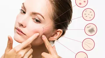 7 reasons your face keeps on breaking out