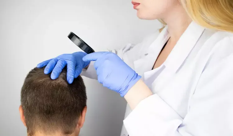 5 Helpful Tips to Manage Alopecia Areata