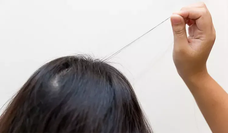 Is hair pulling hereditary?
