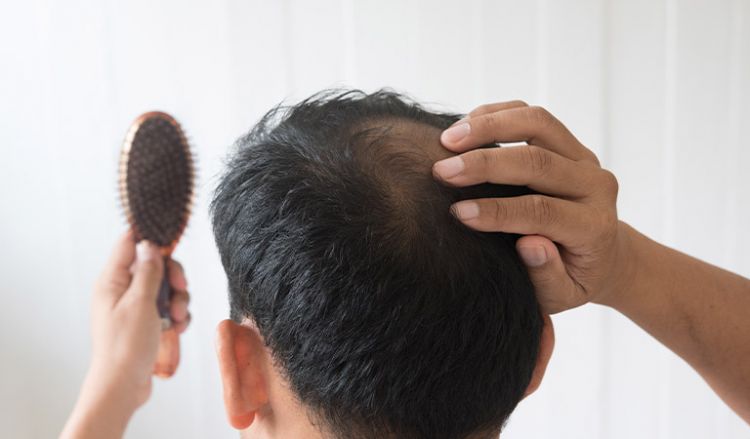 20 effective ways to stop hair fall in men