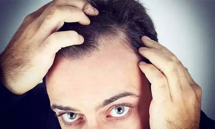 Mesotherapy Treatment for Hair Loss and Hair Growth | Dr Batra's™ Mesotherapy Treatment for Hair Loss and Hair Growth | Dr Batra's™