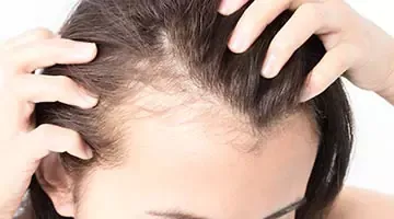 How to prevent thinning hair?
