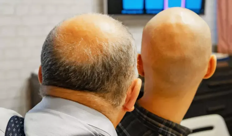 How To Stop Hereditary Hair Loss Naturally? - Dr. Batra's® How To Stop Hereditary Hair Loss Naturally? - Dr. Batra's®