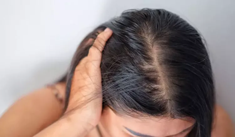 Winter hair problems and tips to avoid them | Dr Batra's™ Winter hair problems and tips to avoid them | Dr Batra's™