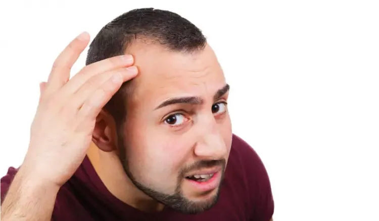 Male Pattern Hair Loss: Symptoms & Homeopathy Treatment