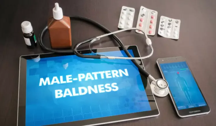 Ways to manage Male Pattern Baldness