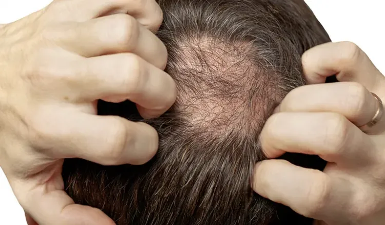 10 Most effective hair loss treatments
