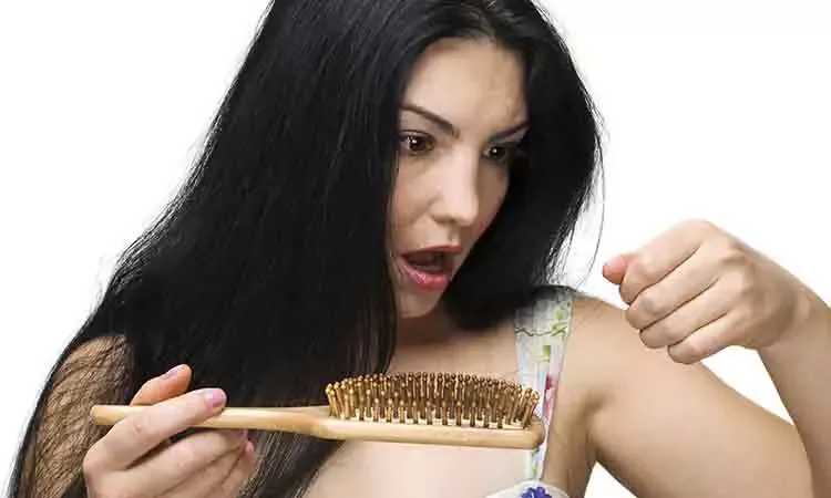 9 Common Reasons for Hair Loss in Women
