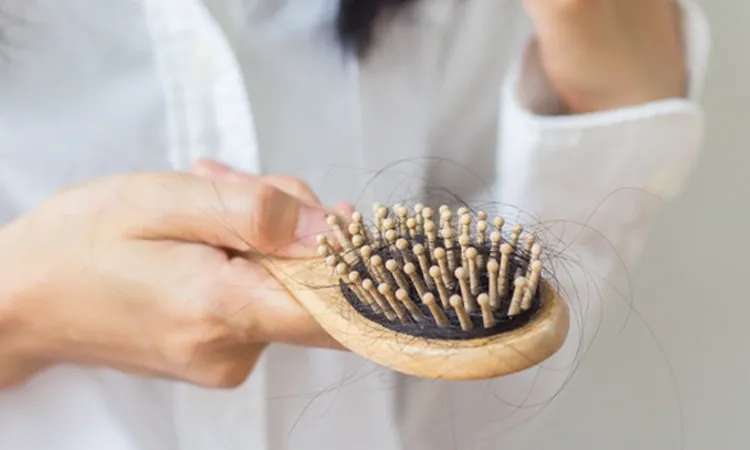 THE DYNAMICS OF HAIR LOSS & HOMEOPATHIC TREATMENT