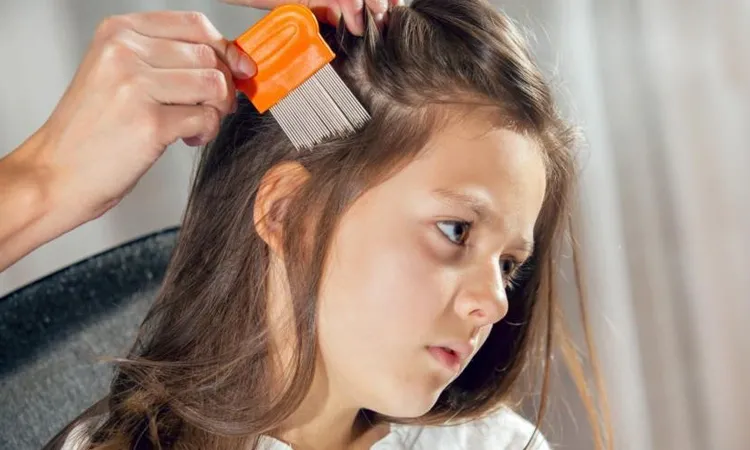 Hair Lice: What a Parent Should Know