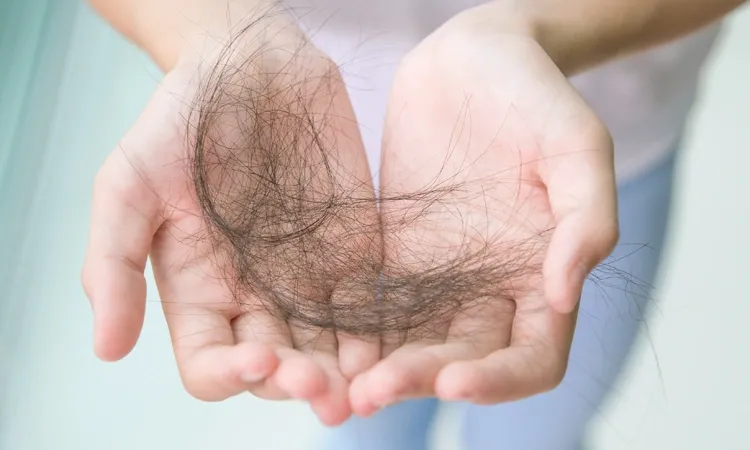  Hair loss Eligibility Criteria