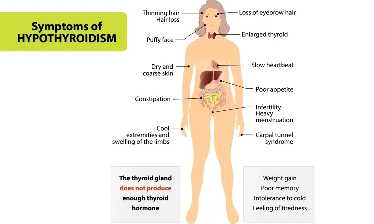 Hypothyroid did not allow flaking to stop…