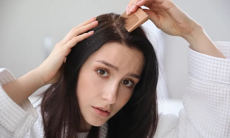 Is hair care regime to be blamed for Dandruff?