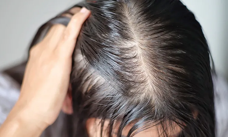 An ounce of prevention of Hair thinning is worth a pound of cure...