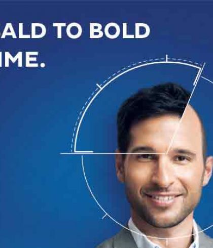 Say Goodbye to Hair Fall with Hair Transplant Say Goodbye to Hair Fall with Hair Transplant