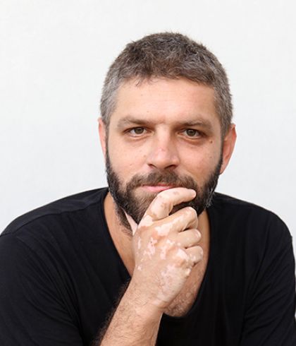 Can vitiligo go away by itself? | Dr Batra’s™