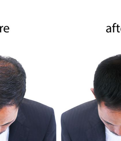 CAN GRO HAIR GROW THE HAIR? | Dr Batra's™ CAN GRO HAIR GROW THE HAIR? | Dr Batra's™