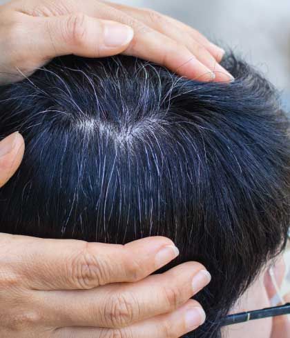 Should You Worry If Your Child Has Grey Hair