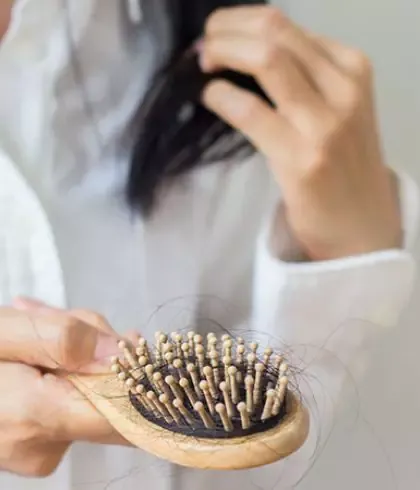 5 Best Homeopathic Medicines For Hair Loss | Dr Batra's™