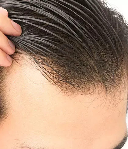 Can homeopathy help your hair grow back after thinning?