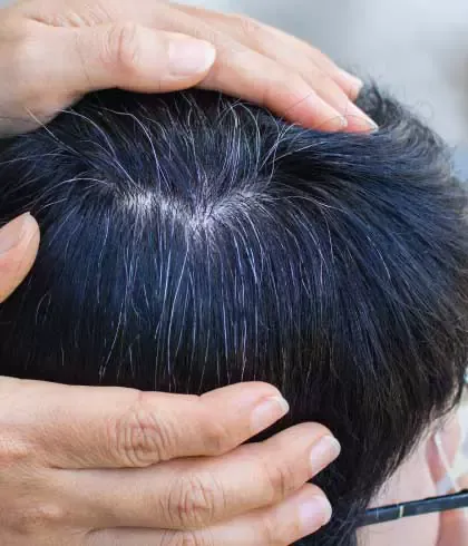 Should You Worry If Your Child Has Grey Hair? Should You Worry If Your Child Has Grey Hair?
