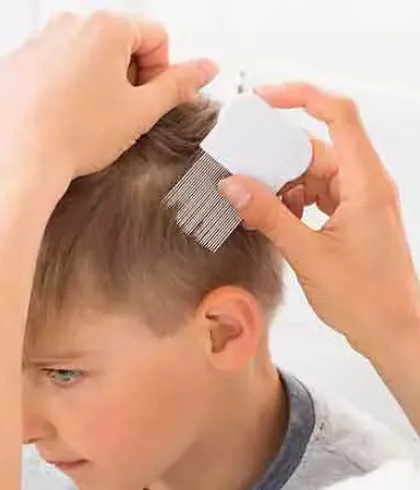 Hair Loss in Children | Causes of Hair Loss | Dr Batra's™