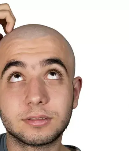 What I Learnt After Shaving My Head  Tips For Growing Out A Shaved or Bald  Head  YouTube