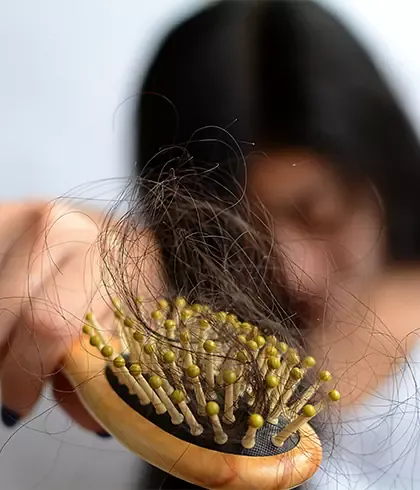 Best Hair Growth Treatment Mumbai, Hair loss treatment Cost India