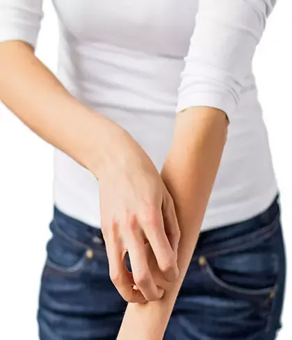 Nothing helped me get rid of the annoying itch until I discovered Homoeopathy