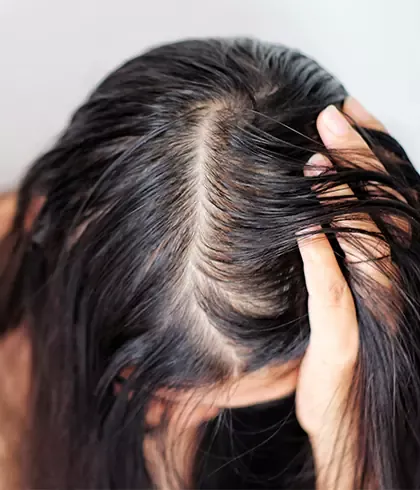 Hairstyles For Female Pattern Hair Loss - Dr. Batra's®