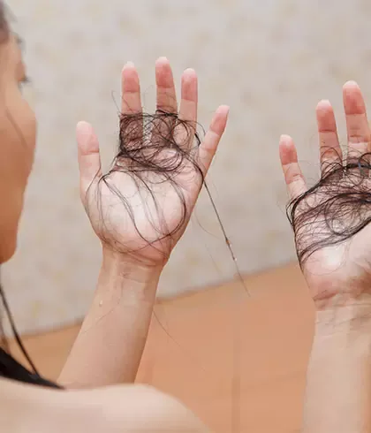 Home Remedies To Prevent Hair Fall In Monsoon - Dr. Batra's® Home Remedies To Prevent Hair Fall In Monsoon - Dr. Batra's®