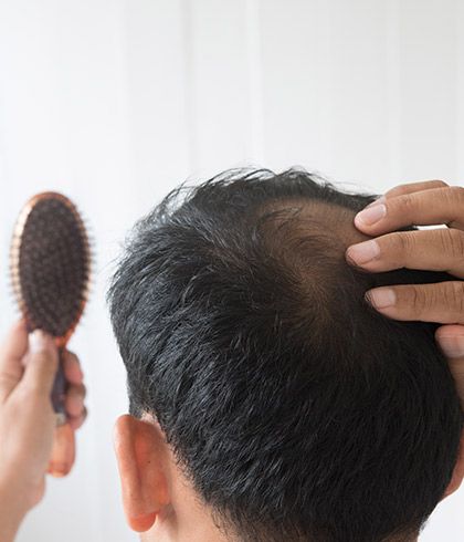 Top 20 effective ways to stop hair fall in men - Dr Batra's® Top 20 effective ways to stop hair fall in men - Dr Batra's®