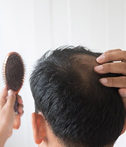 20 effective ways to stop hair fall in men