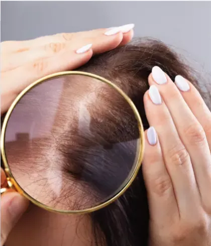 Say goodbye to hair problems this monsoon with homeopathy