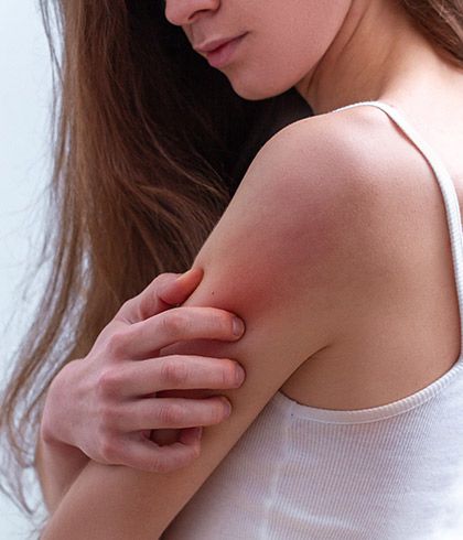 5 things to know before skin allergy treatment