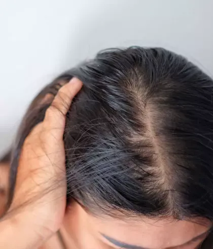 Winter hair problems and tips to avoid them | Dr Batra's™ Winter hair problems and tips to avoid them | Dr Batra's™
