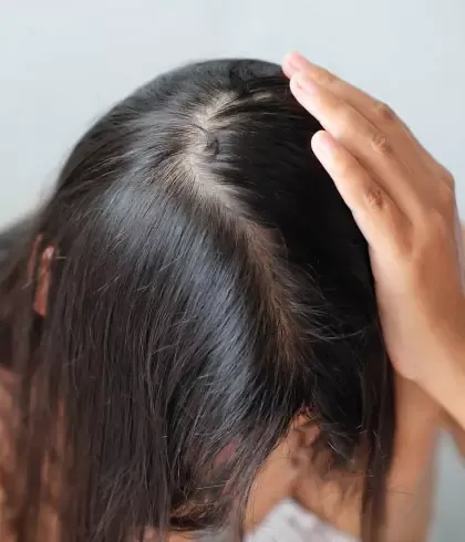 10 bad habits causing hair thinning | Dr Batra's™