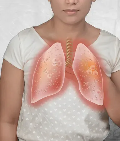 12 Types of lung infections