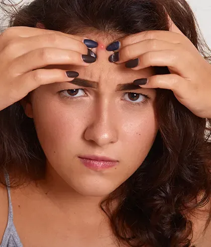 Reasons for forehead pimples