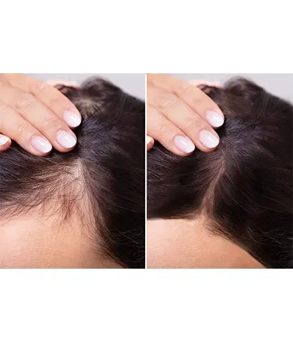 Which is the best new hair treatment?