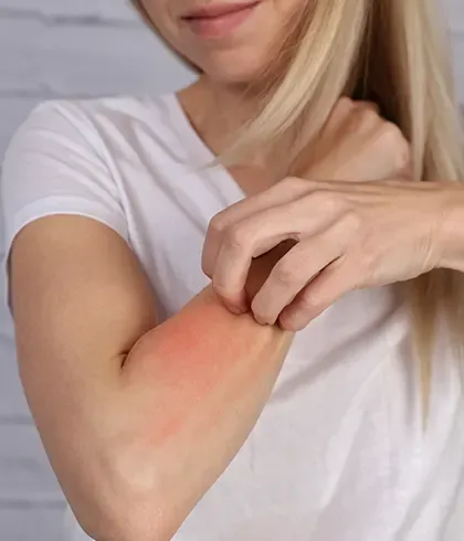 Understanding food allergy symptoms