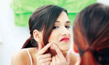 Top five questions by people who suffer from acne