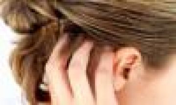 Scalp Psoriasis Treatment in Homeopathy